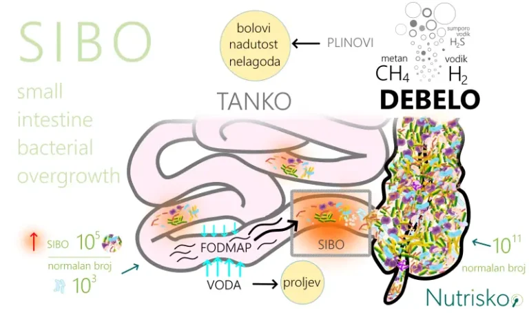 FODMAP jelovnik za SIBO ilustracija