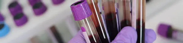 laboratorij prehrana kod anemije
